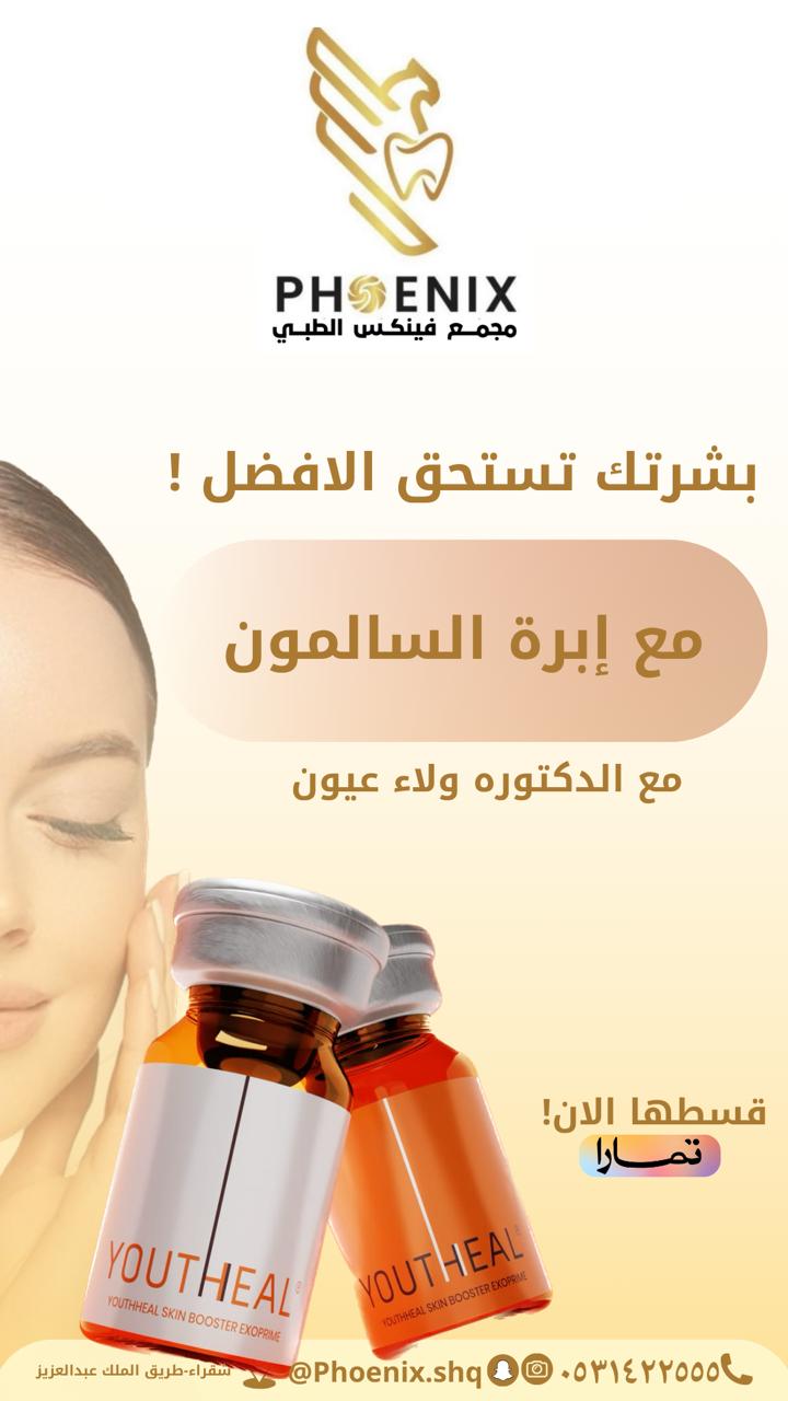 ابرة السالمون